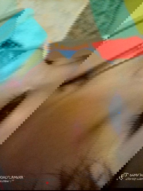 Bukol sa pisngi ni baby