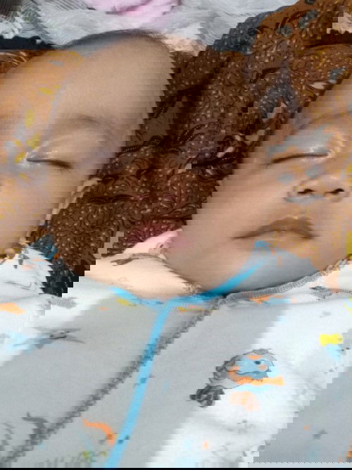 Obat panu yang manjur dan aman untuk anak usia 6bln apa ya bun?