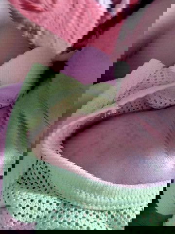 มีแม่ท่านใหนที่ลูกมีผดขึ้นแบบนี้บ้างค่ะ  ใช้อะไรถึงหายค่ะ