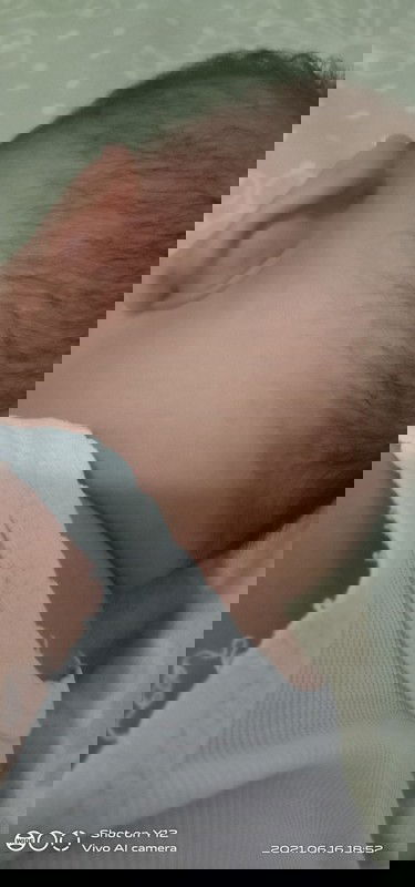 bengkak ngk tau kenpa