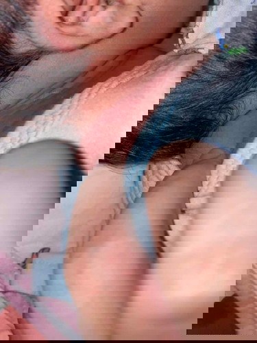 น้องคอแดง น่าจะเกิดจากสาเหตุอะไรค่ะ