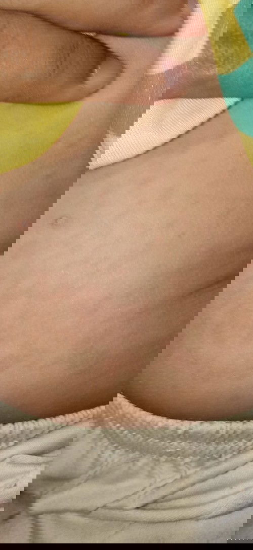 Ruam pasca vaksin campak