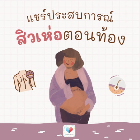 ฮอร์โมนเปลี่ยนแปลง 🤰 สิวเห่อช่วงท้อง! คอมเมนต์เล่าให้ฟังหน่อยค่า