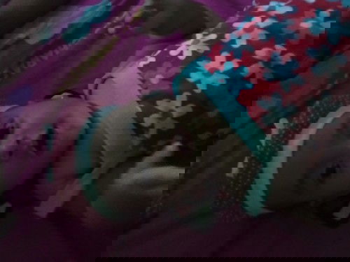 kenapa lipatan pantat si kecil kasar muncul bintik" berisi air?