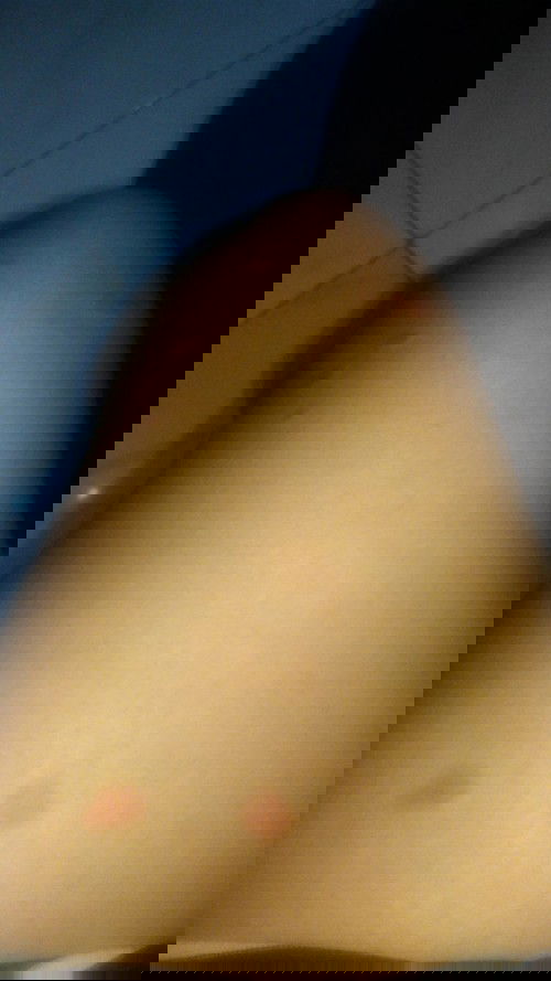 Pasca melahirkan kluar bintik merah gatel