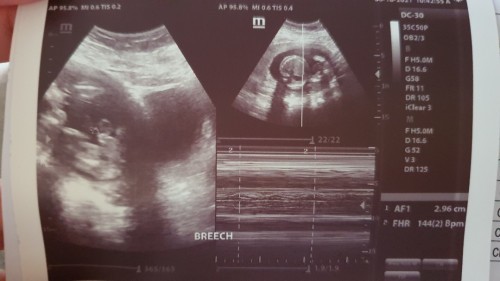 What do you think? Boy or Girl?