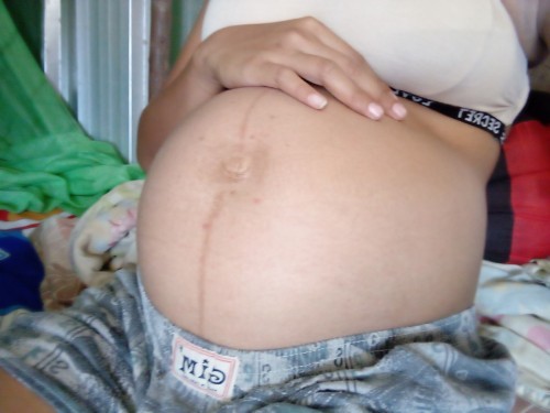 กำหนดคลอด7กรกฎาคมแม่รู้สึกปวดท้องเหมือนปจดมาตอนนี้แยกไม่ออกเลยคะว่าเจ็บท้องเตือนหรือเจ็บท้องหลอก😣