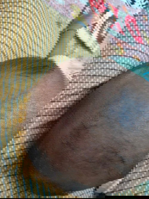 Tentang kulit kepala bayi