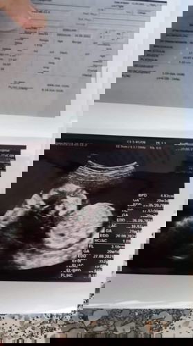 ดูออกกันไหมค่ะว่าเพศหญิงหรือเพศชาย