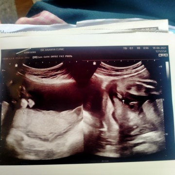 คุณเเม่ช่วยเเนะนำหน่อยจ้า