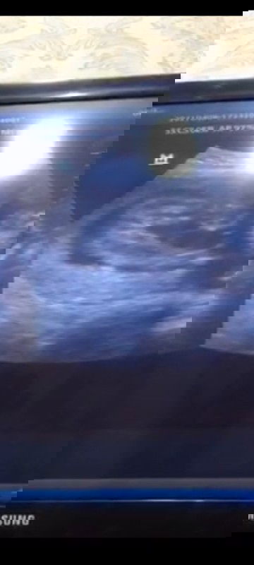 Kira" ini JK Cowo apa Cewe ya ?