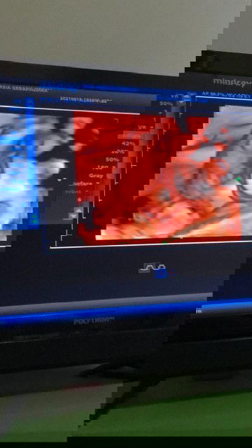 minta tips biar baby cepet turun kepala nya