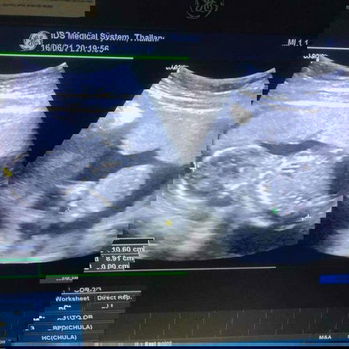 น้อง4 เดือน แม่ๆคิดว่าเป็นชายหรือ หญิง