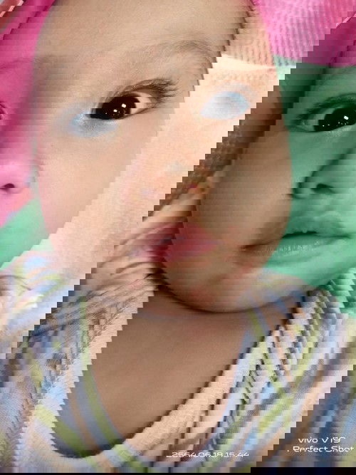 แพ้นมวัวดูยังไงคะ