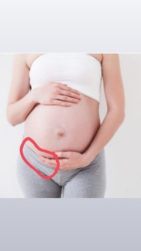 33+6w ชอบปวดท้องจี๊ดๆ แล้วปวดร้าวบริเวณที่วงไว้ ปกติไหมคะ เดินลำบากด้วย เริ่มปวดขามาก