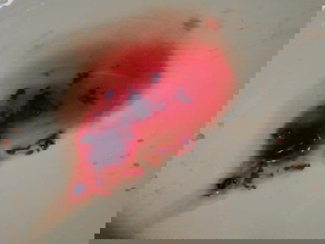 Hi may 3 2021 last period ko tapos June 3hindi ako dinatnan tpos June 15 nag spot at j 17 heavy