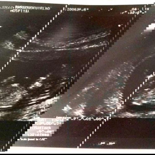 แม่ๆทีมธันวาตอนนี้อาการเป็นไงกันบ้างแล้วคะ ❤️