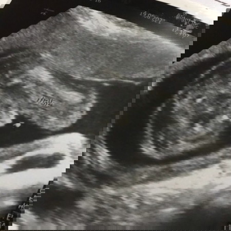 ขอความคิดเห็นช่วยดูหน่อยจ้า