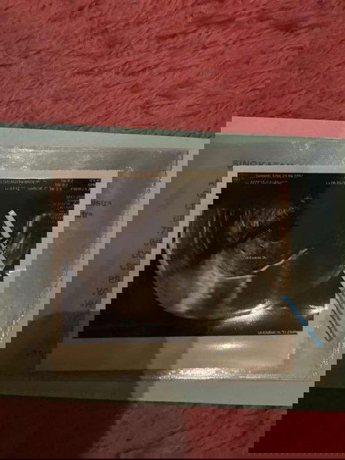 Tespek positif tapi di usg masih penebalan dinding rahim