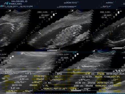 Masalah berat badan saat hamil