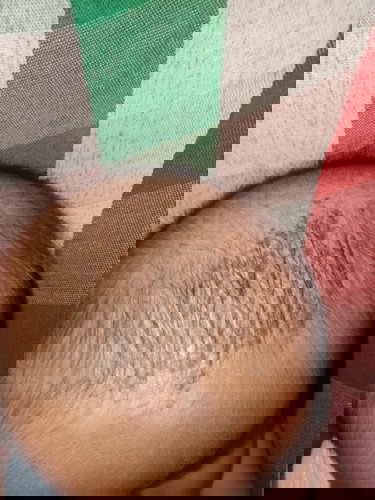 หัวลูกเป็นแบบนี้เกิดจากอะไรค่ะขอคำแนะนำหน่อยค่ะ