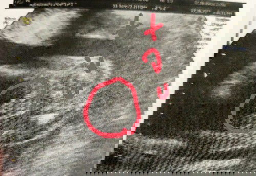 ช่วยตั้งชื่อเล่นลูกหน่อยค่ะ พ่อชื่อบุญมี แม่ชื่อสบู่ ลูกชายคะ ลูกคนแรกตอนนี้5เดือนแล้วคะ👶💖