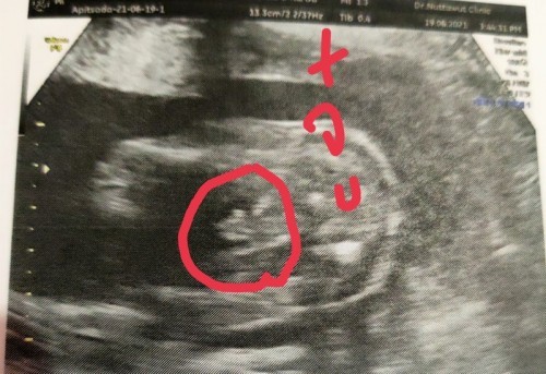 ช่วยตั้งชื่อเล่นลูกหน่อยค่ะ พ่อชื่อบุญมี แม่ชื่อสบู่ ลูกชายคะ ลูกคนแรกตอนนี้5เดือนแล้วคะ👶💖