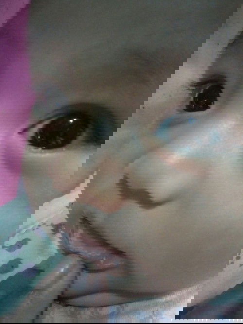 Solusi hilangkan jamur dimulut baby