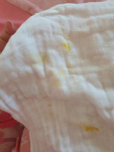 Bé e bị ọc ra 1 ít chất nhầy màu vàng như này là bị sao ạ? Tập đầu nên còn nhiều bỡ ngỡ lắm ạ.