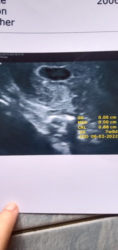 แม่ๆฝากครรภ์ครั้งแรกกี่วีคคะ