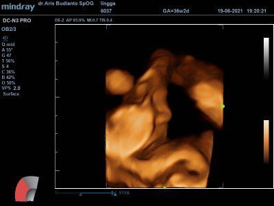 Cara menambah BB bayi?