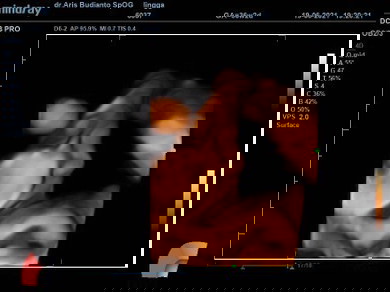 Cara menambah BB bayi?