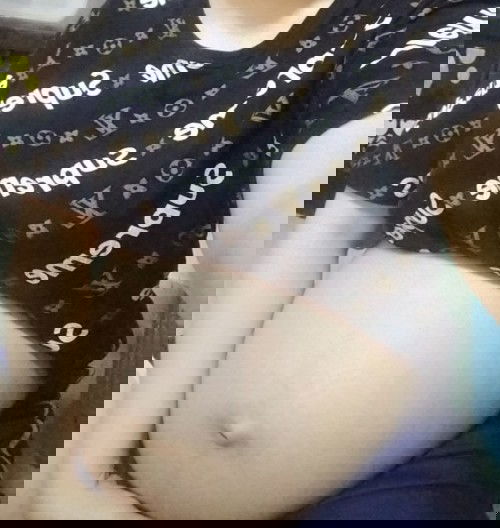 เจ็บกระดูกเชิงกราน