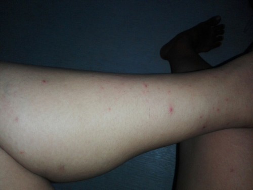 Butlig na makati at may tubig