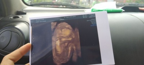 Usia kandungan 22weeks