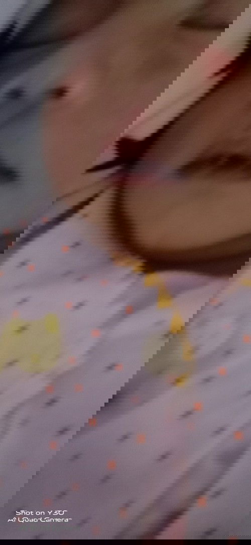 Bibir pecah pecah pada bayi baru lahir