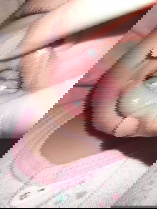 Gigi taring tumbuh lebih awal