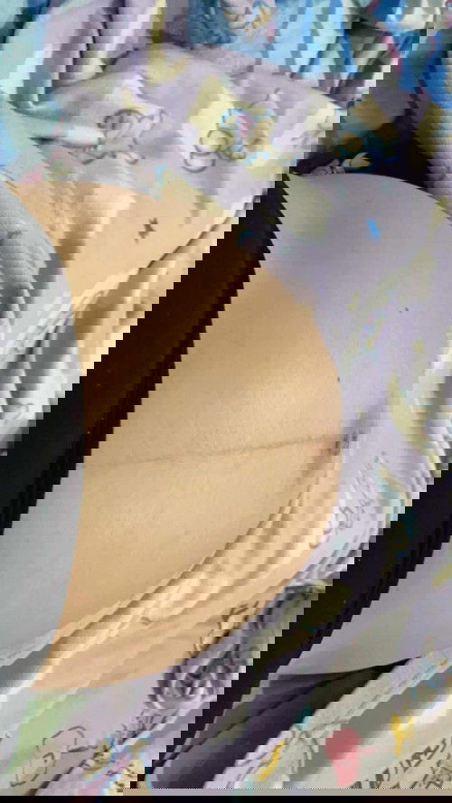 น้องโก่งตัวบ่อยๆ