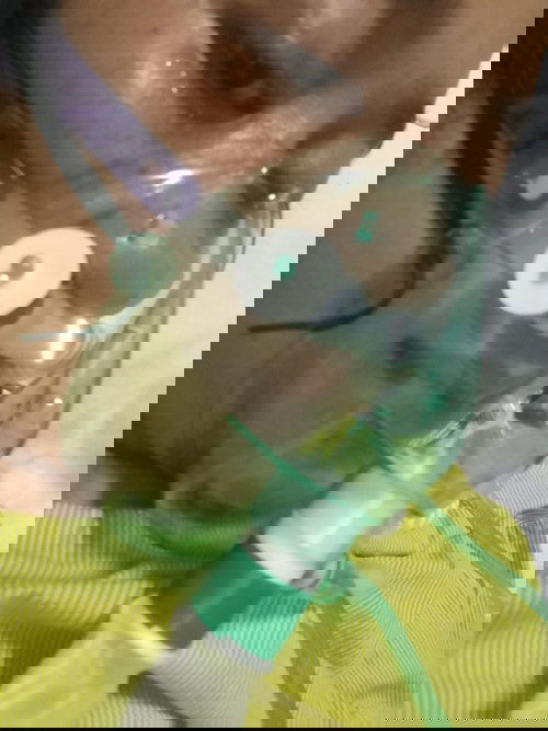 Kena covid di kehamilan 31 minggu