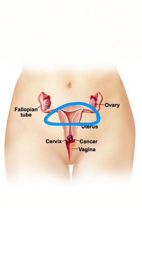 สอบถามค่ะ เจ็บจี๊ดๆตรงนี้