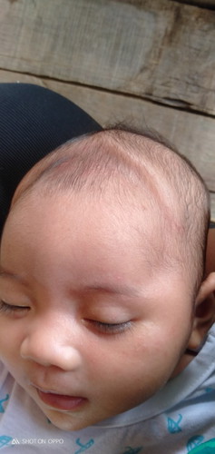 Bunda kenapa ya kepala anak saya gini?