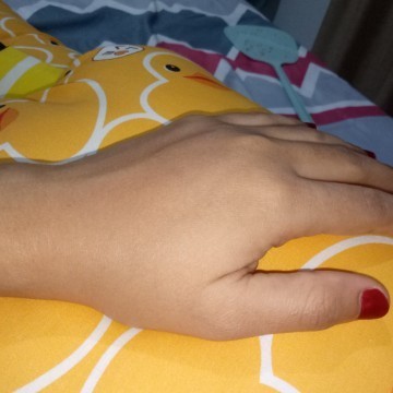 Hamil 7 bln, Kulit tangan lengan hingga siku super kering gatal perih pecah2