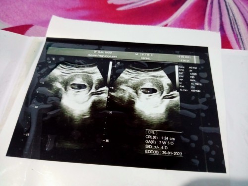 Kandungan saya lemah keluar flek sudah 22 hari
Bagaimana solusi untuk mengatasi masalah kehamilan