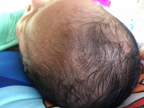 สอบถามแม่ๆค่ะ