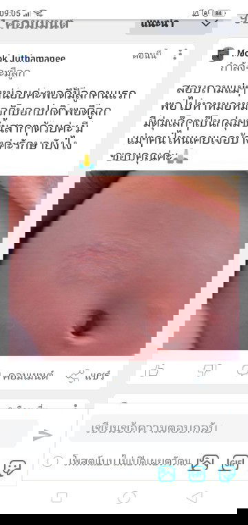 ขอบคุณค่ะ รบกวนแนะนำหน่อยนะค่ะ