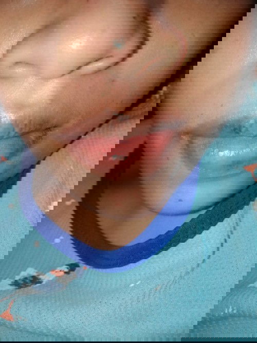 Bibir gatal perih dan kering