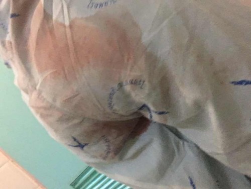 ฝากแชร์เตือนแม่ๆ ห้าวๆ ท้องแล้วเบาได้เบานะคะ🤦🏻♀️