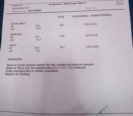 ano po kaya result ng xray pelvimetry ko?