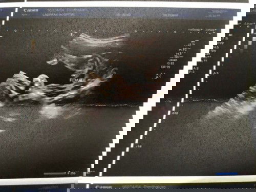 แม่ๆช่วยบอกวิธีดูเพศน้องหน่อยค่ะ