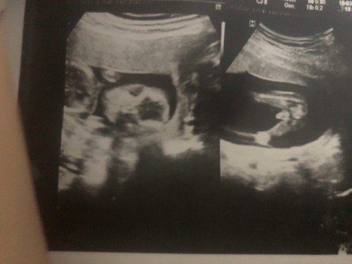 ขอสอบถามจ้า